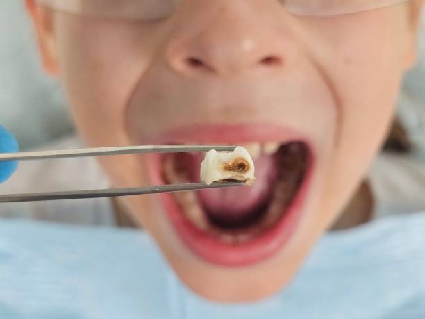 Best Pediatric Emergency Dentist in Center Point, IA